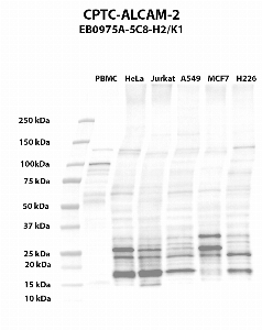 点击放大图像Western blot，使用CPTC-ALCAM-2作为针对PBMC（第2道）、HeLa（第3道）、Jurkat（第4道）、A549（第5道）、MCF7（第6道）和NCI-H226（第7道）全细胞裂解物的主要抗体。预期分子量-65.1 kDa、63.7 kDa，15.1 kDa和33.9 kDa。还包括分子量标准（车道1）。