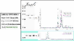 Click to enlarge image Automated WB (Simple Western) using CPTC-ADA-1 as primary antibody against the whole lysate of breast, ovary, spleen, endometrium and lung tissues. Expected MW is 40.8 Kda. The antibody presumably recognize the target in tested lysates. The same cell lysates were probed with an anti-CytC antibody (bottom panel).