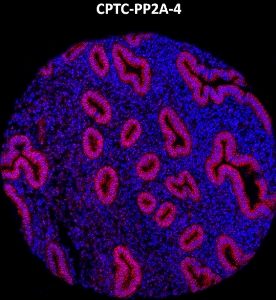 Click to enlarge image Imaging mass cytometry on normal prostate tissue core using CPTC-PP2A-4 metal-labeled antibody.  Data shows an overlay of the target protein signal (red) and DNA (blue). Dilution: 1:100 of 0.5mg/mL stock. Signal was also obtained in other normal tissues (liver, spleen, prostate, colon, pancreas, breast, testis, endometrium, appendix, and kidney) and cancer tissues (breast, colon, ovarian, lung, and prostate).