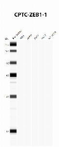 Click to enlarge image Automated Western Blot using CPTC-ZEB1-1 as primary antibody against cell lysates A549, H226, HeLa, Jurkat and MCF7. Expected MW of 124 KDa. All cell lysates negative.  Molecular weight standards are also included (lane 1).