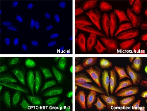 点击放大图像CPTC-KRT B-1组抗体对人细胞系HeLa的免疫荧光染色显示定位于细胞骨架、胞浆、胞外区或分泌区等。