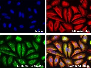 Click to enlarge image Immunofluorescence staining of human cell line HeLa with CPTC-KRT Group B-1 Ab shows localization to the cytoskeleton, cytosol, extracellular region or secreted, other.