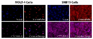 Click to enlarge image Immunofluorescence staining using CPTC-SVIL-1 as primary antibody (pink-violet) against MOLT-4 and SNB19 cells.  Both cell lines show SVIL protein subcellular localization in the cell membrane, cytoskeleton and cytoplasm.