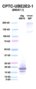Click to enlarge image Western Blot using CPTC-UBE2E2-1 as primary Ab against UBE2E2 (rAg 00015) (lane 2). Also included are molecular wt. standards (lane 1) and mouse IgG control (lane 3).