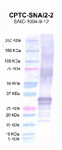 Click to enlarge image Western blot using CPTC-SNAI2-2 as primary antibody against full length SLUG protein (lane 2) with expected MW of 32.7KD.  Molecular weight standards are also included (lane 1).