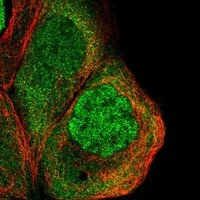 Click to enlarge image Results provided by the Human Protein Atlas (www.proteinatlas.org). The subcellular location is supported by literature. Immunofluorescent staining of human cell line A-431 shows localization to nucleoplasm & cytosol. Human assay: A-431 fixed with PFA, dilution: 1:400
Human assay: U-2 OS fixed with PFA, dilution: 1:400
Human assay: U-251 MG fixed with PFA, dilution: 1:400