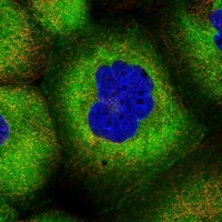 Click to enlarge image Results provided by the Human Protein Atlas (www.proteinatlas.org).  The subcellular location is supported by literature. Immunofluorescent staining of human cell line A-431 shows localization to plasma membrane & cytosol. Human assay: A-431 fixed with PFA, dilution: 1:2000
Human assay: U-2 OS fixed with PFA, dilution: 1:2000
Human assay: U-251 MG fixed with PFA, dilution: 1:2000