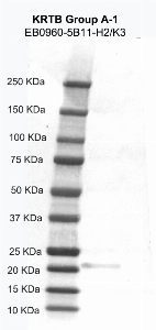 Click to enlarge image Western Blot using CPTC-KRT Group A-1 as primary antibody against KRT19 recombinant protein (lane 2). Also included are molecular weight standard (lane 1)