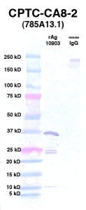 点击放大图像Western Blot，使用CPTC-CA8-2作为Ag 10903的主要抗体（通道2）。还包括分子重量标准（通道1）和小鼠IgG控制（通道3）。