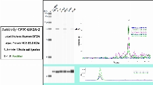 Click to enlarge image Automated WB (Simple Western) using CPTC-EIF2A-2 as primary antibody against the whole lysate of PBMC, HeLa, Jurkat, A549, MCF7 and H226. Expected MW is 65 KDa. The antibody recognizes the target in HeLa, A549 adn H226 lysates. The same cell lysates were probed with an anti-CytC antibody (bottom panel).