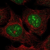 Click to enlarge image Results provided by the Human Protein Atlas (www.proteinatlas.org). The subcellular location is supported by literature. Immunofluorescent staining of human cell line U-2 OS shows localization to nucleoplasm & nucleoli. 	

Human assay: A549 fixed with PFA, dilution: 1:50
Human assay: RH-30 fixed with PFA, dilution: 1:50
Human assay: U-2 OS fixed with PFA, dilution: 1:50