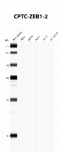 Click to enlarge image Automated Western Blot using CPTC-ZEB1-2 as primary antibody against cell lysates A549, H226, HeLa, Jurkat and MCF7. Expected MW of 124 KDa. All cell lysates negative.  Molecular weight standards are also included (lane 1).