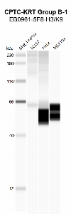 Click to enlarge image Automated western blot using CPTC-KRT Group B-1 as primary antibody against LCL57, HeLa, and MCF10A cell lysates. Molecular weight standard are also included.