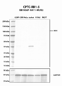 Click to enlarge image Western blot using CPTC-RB1-5 as primary antibody against whole cell lysates CCRF-CEM (lane 2), HeLa (lane 3), Jurkat (lane 4), K-562 (lane 5), and MCF7 (lane 6). The expected molecular weight is 106.2 kDa.  All cell lines are negative.