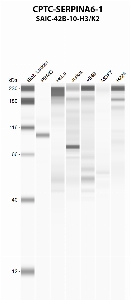 Click to enlarge image Automated western blot using CPTC-SERPINA6-1 as primary antibody against PBMC (lane 2), HeLa (lane 3), Jurkat (lane 4), A549 (lane 5), MCF7 (lane 6), and NCI-H226 (lane 7) whole cell lysates.  Expected molecular weight - 45.1 kDa.  Molecular weight standards are also included (lane 1).
