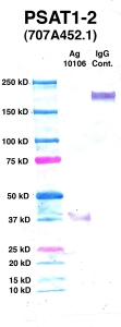 Click to enlarge image Western Blot using CPTC-PSAT1-2 as primary Ab against PSAT1 (Ag 10106) (lane 2). Also included are molecular wt. standards (lane 1) and mouse IgG control (lane 3).