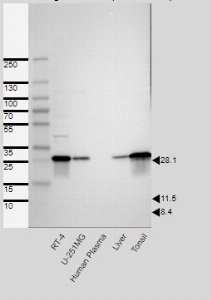 Click to enlarge image Results provided by the Human Protein Atlas (www.proteinatlas.org). Single band corresponding to the predicted size in kDa (+/-20%). Analysis performed using a standard panel of samples. Antibody dilution: 1:500