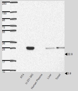 Click to enlarge image Results provided by the Human Protein Atlas (www.proteinatlas.org). Single band corresponding to the predicted size in kDa (+/-20%). Analysis performed using a standard panel of samples. Antibody dilution: 1:500