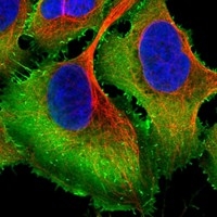 Click to enlarge image Results provided by the Human Protein Atlas (www.proteinatlas.org). The subcellular location is supported by literature. Immunofluorescent staining of human cell line U-2 OS shows localization to plasma membrane. Human assay: A-431 fixed with PFA, dilution: 1:2000
Human assay: U-2 OS fixed with PFA, dilution: 1:2000
Human assay: U-251 MG fixed with PFA, dilution: 1:2000