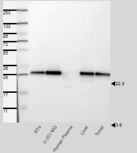 Click to enlarge image Results provided by the Human Protein Atlas (www.proteinatlas.org). Single band differing more than +/-20% from predicted size in kDa and not supported by experimental and/or bioinformatic data. Analysis performed using a standard panel of samples. Antibody dilution: 1:500