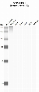 Click to enlarge image Automated western blot using CPTC-B2M-1 as primary antibody against buffy coat (lane 2), HeLa (lane 3), Jurkat (lane 4), A549 (lane 5), MCF7 (lane 6), and H226 (lane 7) whole cell lysates.  Expected molecular weight - 13.7 kDa.  Molecular weight standards are also included (lane 1).