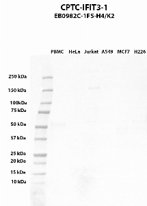 Click to enlarge image Western blot using CPTC-IFIT3-1 as primary antibody against PBMC (lane 2), HeLa (lane 3), Jurkat (lane 4), A549 (lane 5), MCF7 (lane 6), and NCI-H226 (lane 7) whole cell lysates.  Expected molecular weight - 56.0 kDa.  Molecular weight standards are also included (lane 1).