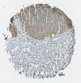 Click to enlarge image Tissue Microarray core immunohistochemically stained with antibody CPTC-PTEN-1