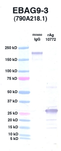 Click to enlarge image Western Blot using CPTC-EBAG9-3 as primary Ab against EBAG9 (rAg 10772) in lane 3. Also included are molecular wt. standards (lane 1) and mouse IgG control (lane 2).