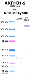 Click to enlarge image Western Blot using CPTC-AKR1B1-2 as primary Ab against cell lysate from TK-10 cells (lane 2). Also included are molecular wt. standards (lane 1) and mouse IgG control (lane 3).