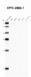 Click to enlarge image Automated Western Blot using CPTC-ZEB2-1 as primary antibody against cell lysates A549, H226, HeLa, Jurkat and MCF7. Expected MW of 136 KDa. All cell lysates negative.  Molecular weight standards are also included (lane 1).