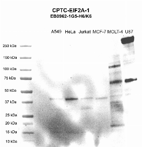 Click to enlarge image Western Blot using CPTC-EIF2A-1 as primary antibody against cell lysates A549 (lane 2), HeLa (lane 3), Jurkat (lane 4), MCF-7 (lane 5), MOLT-4 (lane 6), and U87 (lane 7). Molecular weight standards are also included (lane 1). All cell lines are positive. Expected molecular weights – 64.9 kDa, 41.3 kDa, 62.3 kDa, and 57.9 kDa.