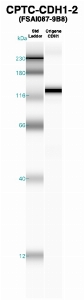 Click to enlarge image Western Blot using CPTC-CDH1-2 as primary Ab against CDH1 (lane 2). Also included are molecular wt. standards (lane 1).