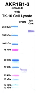 Click to enlarge image Western Blot using CPTC-AKR1B1-3 as primary Ab against cell lysate from TK-10 cells (lane 2). Also included are molecular wt. standards (lane 1) and mouse IgG control (lane 3).