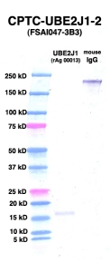 Click to enlarge image Western Blot using CPTC-UBE2J1-2 as primary Ab against UBE2J1 (rAg 00013) (lane 2). Also included are molecular wt. standards (lane 1) and mouse IgG control (lane 3).