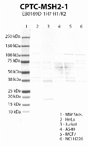 Click to enlarge image Western blot using CPTC-MSH2-1 as primary antibody against HeLa (lane 2), Jurkat (lane 3), A549 (lane 4), MCF7 (lane 5) and NCI H226 (lane 6) cell lysates.  Expected molecular weight 105 kDa.  Molecular weight standards (MW Stds.) are also included (lane 1).  Positive for Cell lines HeLa, MCF7 and NCI H226. Negative/inconsistent results for the other cell lines.