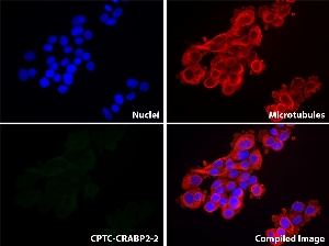 Click to enlarge image Immunofluorescence staining of human cell line OVCAR-3 using CPTC-CRABP2-2 as primary antibody.  CRABP2 protein expression shows localization in the cytoplasm (green).