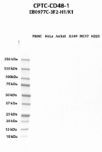 Click to enlarge image Western blot using CPTC-CD48-1 as primary antibody against PBMC (lane 2), HeLa (lane 3), Jurkat (lane 4), A549 (lane 5), MCF7 (lane 6), and NCI-H226 (lane 7) whole cell lysates.  Expected molecular weight - 27.7 kDa and 19.4 kDa.  Molecular weight standards are also included (lane 1).  Target protein is subject to glycosylation which can affect the migration in electrophoresis. This can make the target appear as a higher molecular weight protein.