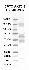 Click to enlarge image Western Blot using CPTC-AKT2-6 as primary Ab against recombinant AKT2 protein (lane 2). Also included are molecular wt. standards (lane 1).