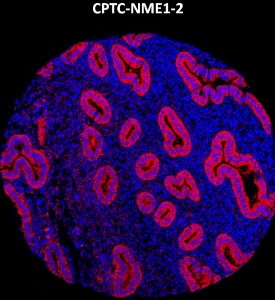 Click to enlarge image Imaging mass cytometry on normal colon tissue core using CPTC-NME1-2 metal-labeled antibody.  Data shows an overlay of the target protein signal (red) and DNA (blue). Dilution: 1:100 of 0.5mg/mL stock. Signal was also obtained in other normal tissues (liver, bone marrow, spleen, prostate, colon, pancreas, breast, lung, testis, endometrium, and appendix) and cancer tissues (breast, colon, ovarian, lung, and prostate).