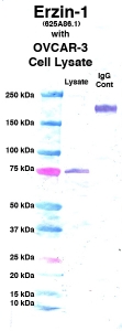 Click to enlarge image Western Blot using CPTC-Ezrin-1 as primary Ab against cell lysate from OVCAR-3 cells (lane 2). Also included are molecular wt. standards (lane 1) and mouse IgG control (lane 3).