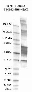 Click to enlarge image Western Blot using CPTC-PAK4-1 as primary antibody against  recombinant human p21 (Cdc42/Rac)-activated kinase 4 (PAK4), transcript variant 1 protein (lane 2). Also included are molecular weight standards (lane 1).