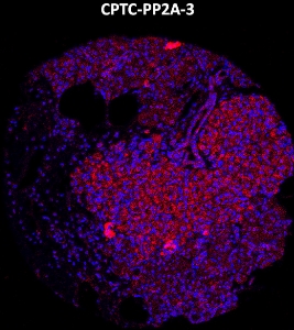 Click to enlarge image Imaging mass cytometry on normal colon tissue core using CPTC-PP2A-3 metal-labeled antibody.  Data shows an overlay of the target protein signal (red) and DNA (blue). Dilution: 1:100 of 0.5mg/mL stock. Signal was also obtained in other normal tissues (liver, bone marrow, placenta, prostate, colon, pancreas, breast, lung, endometrium, appendix, and kidney) and cancer tissues (breast, colon, ovarian, lung, and prostate).