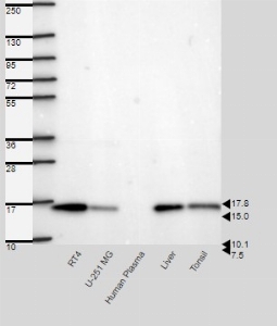 Click to enlarge image Results provided by the Human Protein Atlas (www.proteinatlas.org). Single band corresponding to the predicted size in kDa (+/-20%). Analysis performed using a standard panel of samples. Antibody dilution: 1:500.