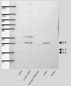 Click to enlarge image Results provided by the Human Protein Atlas (www.proteinatlas.org). Band of predicted size in kDa (+/-20%) with additional bands present. Analysis performed using a standard panel of samples. Antibody dilution: 1:500.