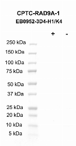 Click to enlarge image Western blot using CPTC-RAD9A-1 as primary antibody against LCL57 cell lysate.  Cell lysate was irradiated with 10 Gy as shown in the ‘+’ indicated lane.  Non-irradiated cell lysate was treated with alkaline phosphatase enzyme as shown in ‘-‘ indicated lane.  Blots were developed using enhanced chemiluminescence. Molecular weight standards are also included.