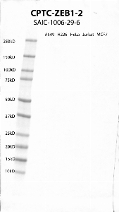 Click to enlarge image Western Blot using CPTC-ZEB1-2 as primary antibody against cell lysates A549, H226, HeLa, Jurkat and MCF7. Expected MW of 124 KDa. All cell lysates negative.  Molecular weight standards are also included (lane 1).