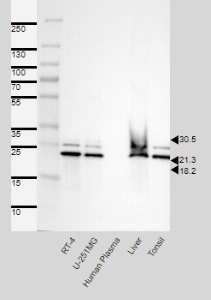 Click to enlarge image Results provided by the Human Protein Atlas (www.proteinatlas.org).

Single band corresponding to the predicted size in kDa (+/-20%).
Analysis performed using a standard panel of samples. Antibody dilution: 1:500