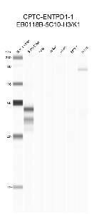 Click to enlarge image Automated western blot using CPTC-ENTPD1-1 as primary antibody against buffy coat (lane 2), HeLa (lane 3), Jurkat (lane 4), A549 (lane 5), MCF7 (lane 6), and H226 (lane 7) cell lysates.  Expected molecular weight - 57.8 kDa.  Molecular weight standards are also included (lane 1). Inconclusive data.