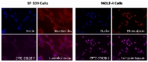 Click to enlarge image Immunofluorescence staining using CPTC-GSK3B-5 as primary antibody (pink-violet) against SF-539 and MOLT-4  cells.  Both cell lines show GSK3B protein subcellular localization in the cytoplasm and cell membrane.