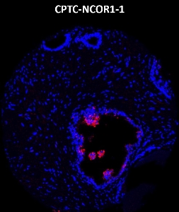 Click to enlarge image Imaging mass cytometry on normal prostate tissue core using CPTC-NCOR1-1 metal-labeled antibody.  Data shows an overlay of the target protein signal (red) and DNA (blue). Dilution: 1:100 of 0.5mg/mL stock. Signal was also obtained in other normal tissues (prostate, appendix, bone marrow, breast, kidney, and placenta) and cancer tissues (breast, colon, prostate, lung, and ovarian).
